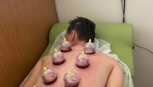 Yerköy Devlet Hastanesi Getat Polikliniğinde belirli günlerde uzman doktor tarafından