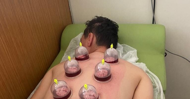 Yerköy Devlet Hastanesi GETAT polikliniğinde  hacamat ve akupunktur tedavi başladı