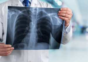 Yerköy Devlet Hastanesi Başhekimi Dr. Ali Demir tarafından yapılan açıklamaya