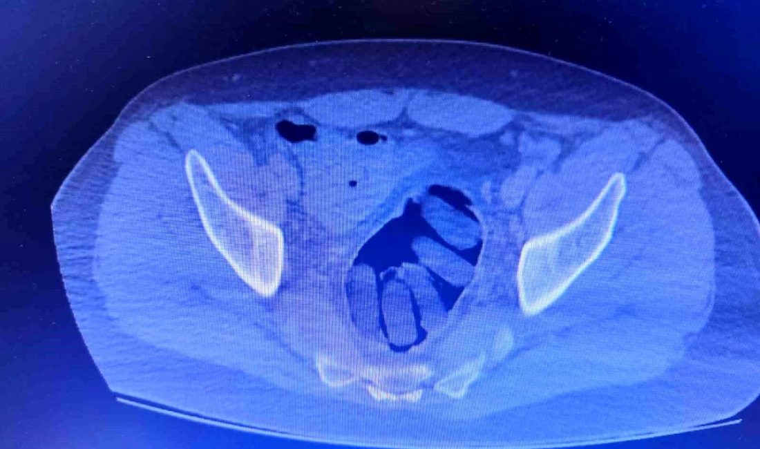 Uyuşturucu kuryelerine büyük darbe: 1 kilo 850 gram uyuşturucu ele