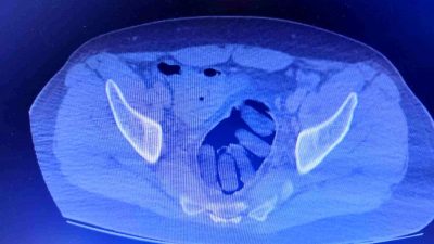 Uyuşturucu kuryelerine büyük darbe: 1 kilo 850 gram uyuşturucu ele