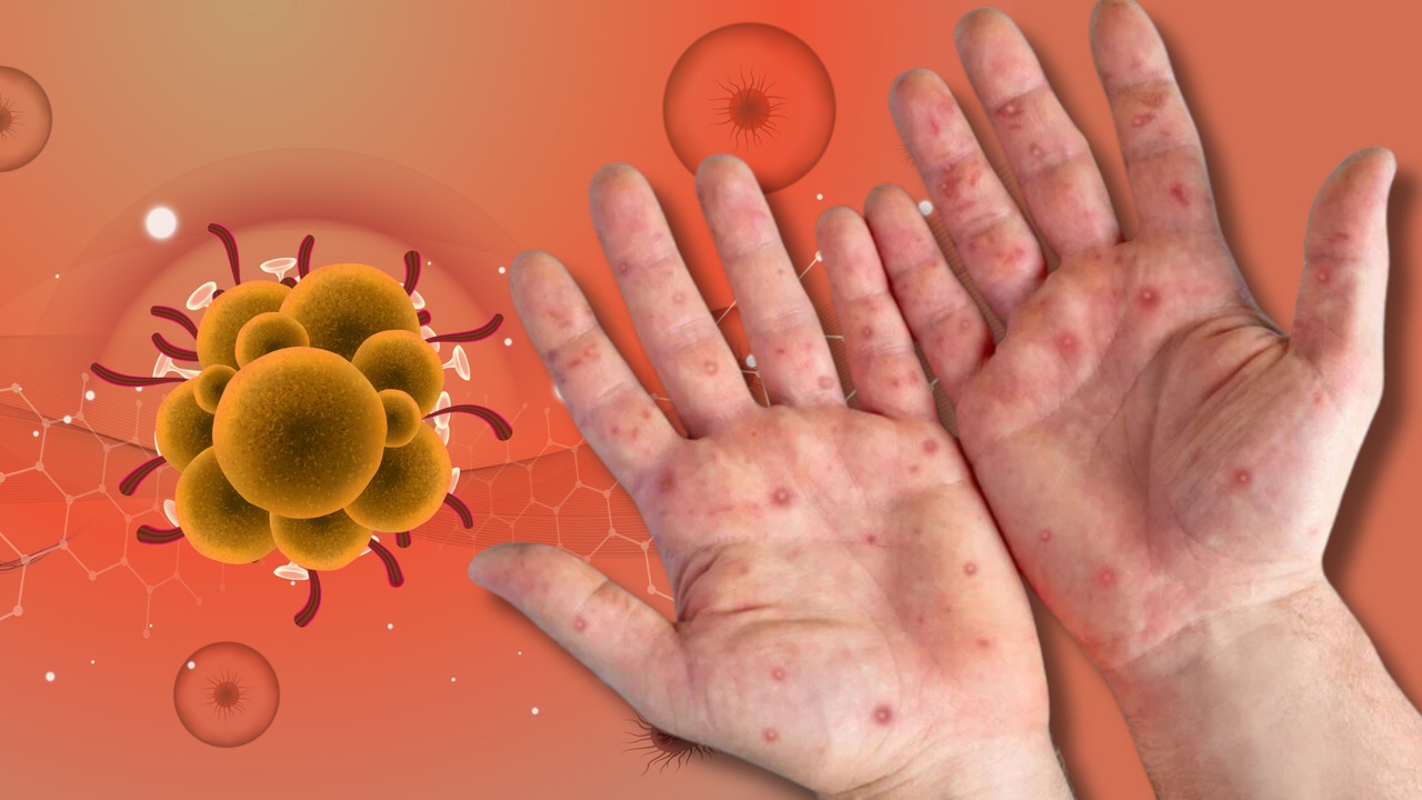 Prof. Dr. Taner Demirer'den Sağlık Bakanlığına Kritik Uyarı: "Afrikalı Öğrencilerin