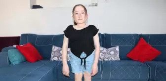 İZMİR’de Fadime (48)- Abdullah Akbay (55) çiftinin skolyoz (omurga eğriliği)