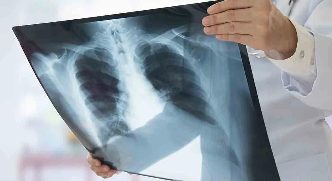 Yerköy Devlet Hastanesi Başhekimi Uzman Dr. Ali Demir, Dünya Pnömoni