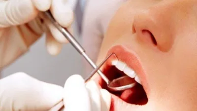 Rüya Tabirleri, Rüyada Dişçiye Gitmek Ne Anlama Gelir? İşte Detaylı Anlamı Dikkatli olunması gerektiğine dair bir uyarı niteliği taşıyan rüyalardan