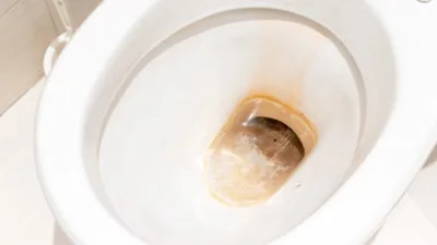 Rüya Tabirleri, Rüyada Pislik Görmek Ne Anlama Gelir? İşte Detaylı Anlamı Rüyada pislik görmek, mal ve temizliğe işarettir. Rüyada insan veya