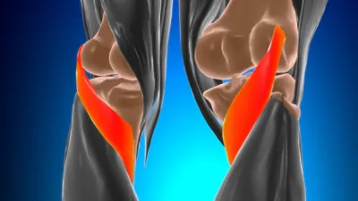 Ön çapraz bağ kopması, diz ekleminde yer alan ve uyluk