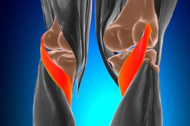 Ön çapraz bağ kopması, diz ekleminde yer alan ve uyluk