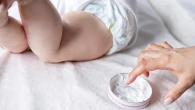 Yeni doğanda en çok rastlanılan sorunlardan biri olan pişik, her