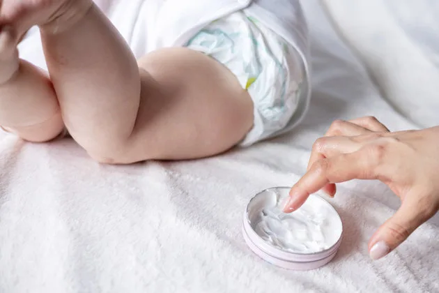 Yeni doğanda en çok rastlanılan sorunlardan biri olan pişik, her