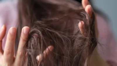 Stres ve kaygı ile başa çıkamayan bireylerde görülen trikotillomani (saç