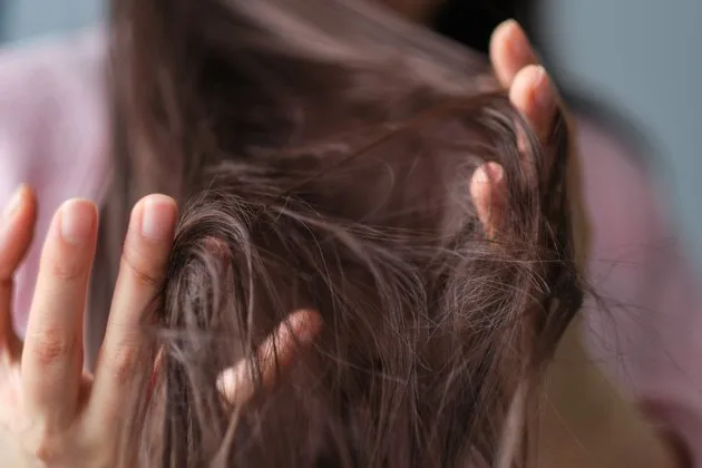 Stres ve kaygı ile başa çıkamayan bireylerde görülen trikotillomani (saç