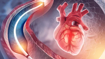 Tıbbi teknolojideki gelişmelerin görüntüleme yöntemlerine de yansımasıyla kalp ve damar