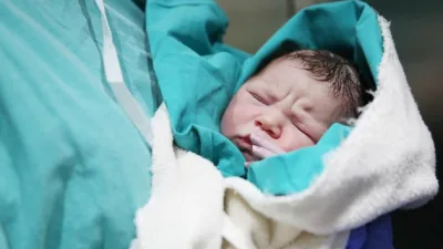 Sarılık, ciltte, göz aklarında ve mukozalarda sarı renkte bir değişimle