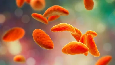 Toksoplazma, dünya genelinde yaygın olarak görülen ve Toxoplasma gondii adlı