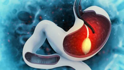 Başta yanlış beslenme alışkanlıkları olmak üzere çeşitli faktörlerin etkisiyle her