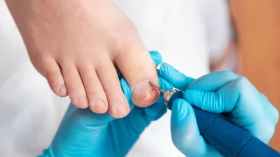 Tırnak batması, çoğu kişinin hafife aldığı ancak ilerlediğinde hem ağrı