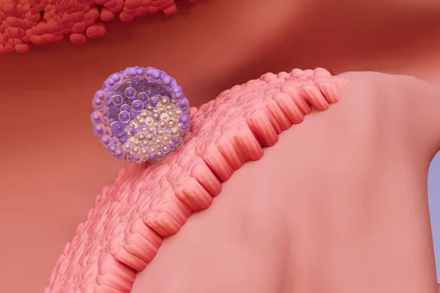 Tüp bebek tedavilerinde başarıyı artırmak için geliştirilen embriyo yapıştırıcısı, özellikle