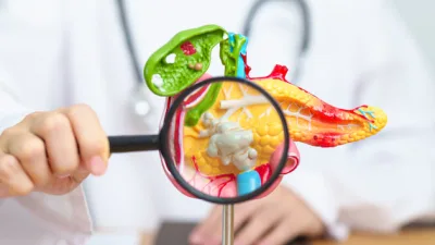 Pankreas İltihaplanması (Pankreatit) Nedir, Belirtileri ve Tedavisi: Hayati Öneme Sahip
