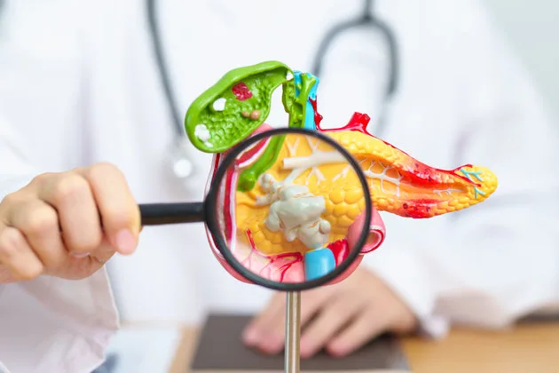 Pankreas İltihaplanması (Pankreatit) Nedir, Belirtileri ve Tedavisi: Hayati Öneme Sahip