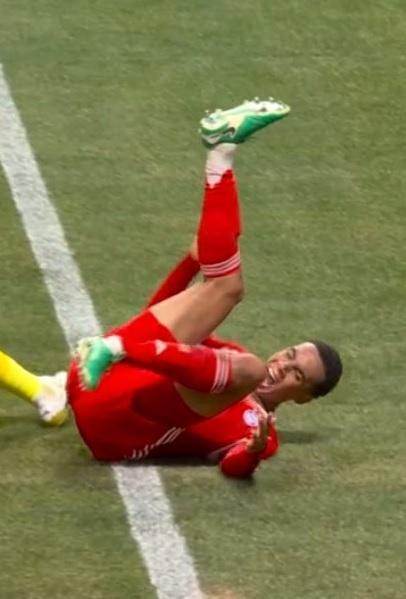 Bayern Münih-PSG maçında şok eden olay! Musiala'nın ayağı kırıldı