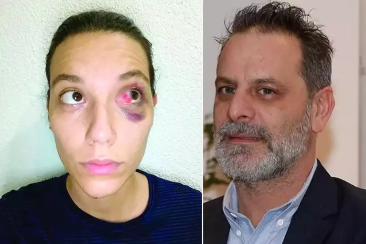 Ozan Güven'in eski sevgilisi Deniz Bulutsuz'u darp etmesi sonucu 2