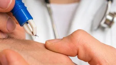 Sivas Cumhuriyet Üniversitesi Rektörü Prof. Dr. Ahmet Şengönül, üniversitenin kene