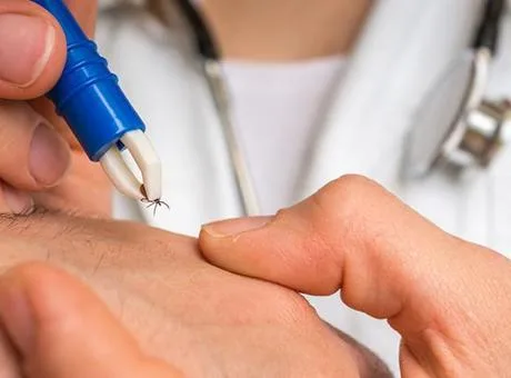 Sivas Cumhuriyet Üniversitesi Rektörü Prof. Dr. Ahmet Şengönül, üniversitenin kene