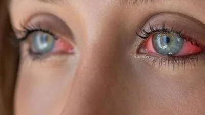 Sonbahar mevsimi, hava değişikliğinin etkisiyle birlikte birçok sağlık sorununu beraberinde