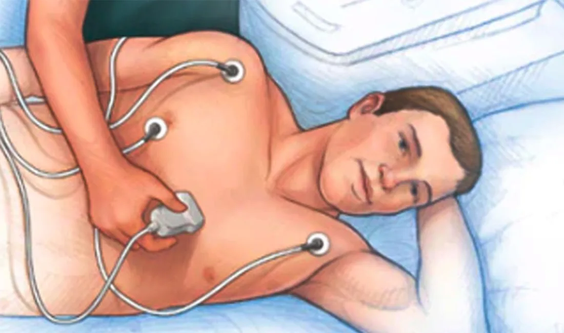 Transtorasik Ekokardiyografi, kalp ve damarların görüntülenmesini sağlayan non-invaziv bir ultrasonografi