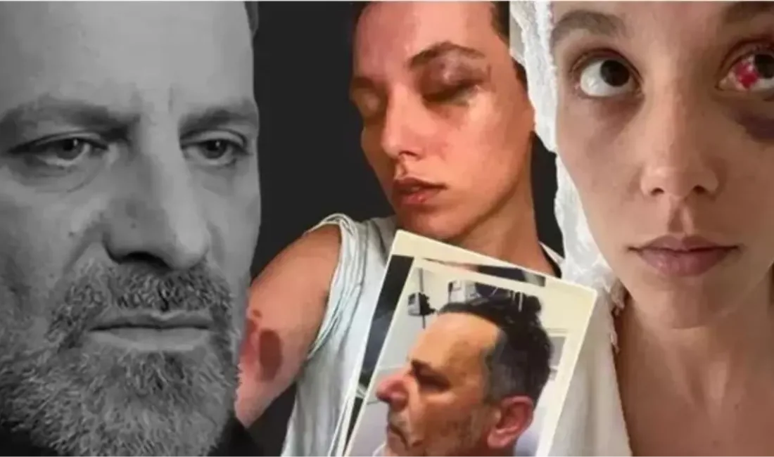 Ozan Güven, eski sevgilisi Deniz Bulutsuz’a yönelik şiddet iddiaları nedeniyle