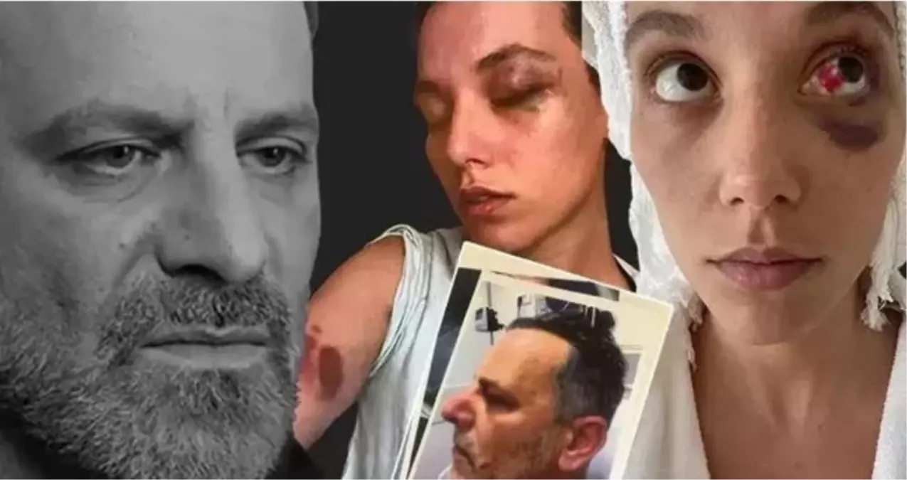 Ozan Güven, eski sevgilisi Deniz Bulutsuz’a yönelik şiddet iddiaları nedeniyle