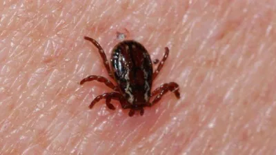 Kene tutunması sonrası Kırım Kongo Kanamalı Ateşi (KKKA) şüphesiyle tedavi