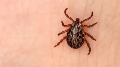 Yerköy ilçemize bağlı Terzili köyünde kene vakası tespit edildi.