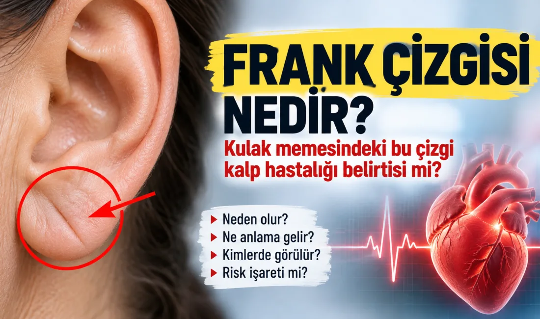 Frank çizgisi nedir, neden olur ve kalp hastalığı belirtisi midir?