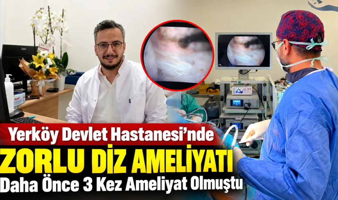 Yerköy ilçemizde, daha önce ön çapraz bağ ve menisküs yırtığı